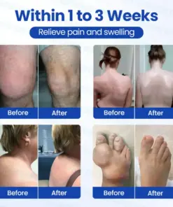 Pryxo® Instant Relief Arthritis Gel