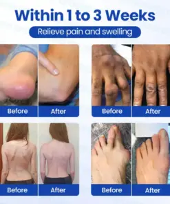 Pryxo® Instant Relief Arthritis Gel