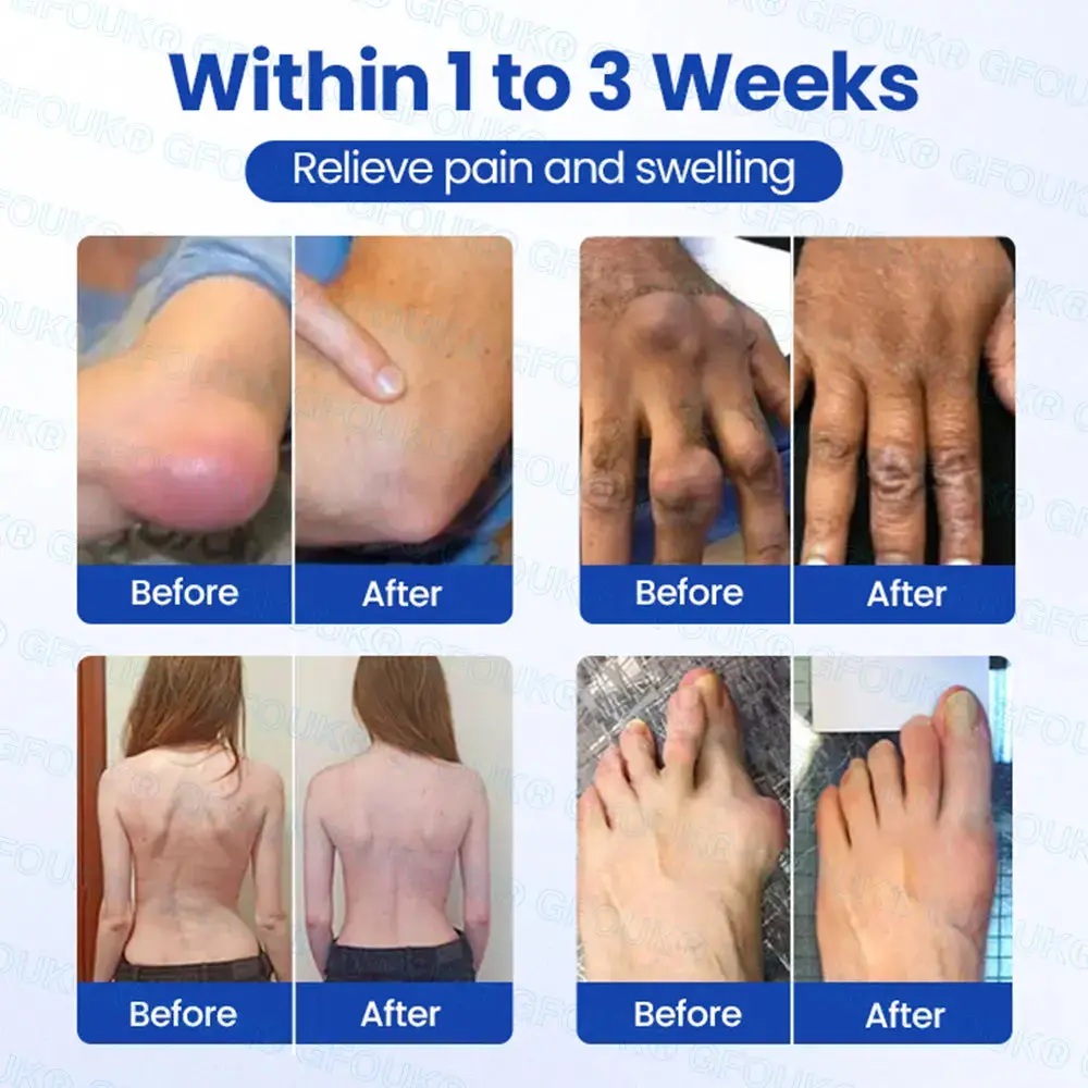 Pryxo® Instant Relief Arthritis Gel