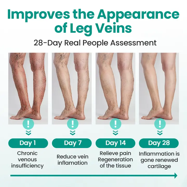 Pryxo™ LegRenew Varicose Veins Patch