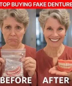 Pryxo™ Medical Full Denture with Strong Suctiond Custom-Fit Full Functional Dentures