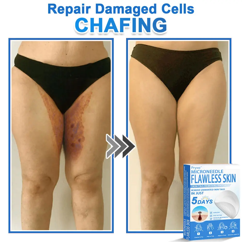 Pryxo™ 2-in-1 Microneedle & Hydrocolloid Patch