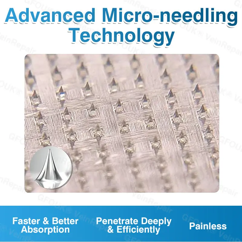 Pryxo™ VeinRepair Microneedle Patch Roll
