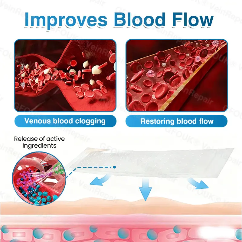 Pryxo™ VeinRepair Microneedle Patch Roll
