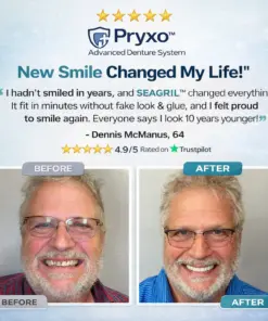 Pryxo™ Complete Dental Restoration Kit