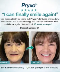 Pryxo™ Complete Dental Restoration Kit