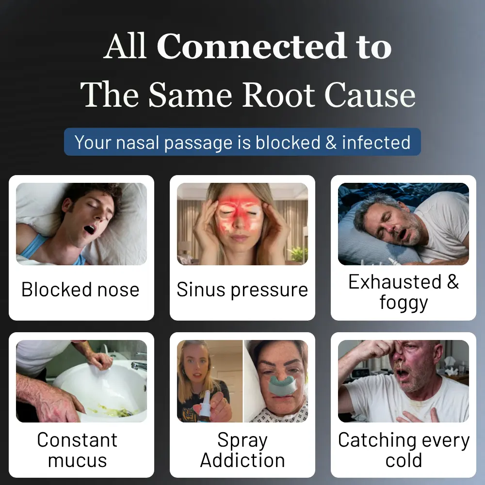 Pryxo™ Nasal Iodine Spray